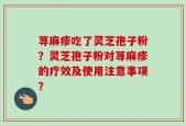 荨麻疹吃了灵芝孢子粉？灵芝孢子粉对荨麻疹的疗效及使用注意事项？