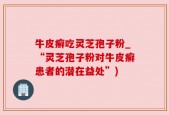 牛皮癣吃灵芝孢子粉_“灵芝孢子粉对牛皮癣患者的潜在益处”)
