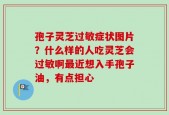 孢子灵芝过敏症状图片？什么样的人吃灵芝会过敏啊最近想入手孢子油，有点担心