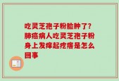 吃灵芝孢子粉脸肿了？肺癌病人吃灵芝孢子粉身上发痒起疙瘩是怎么回事