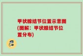 甲状腺结节位置示意图(图解：甲状腺结节位置分布)