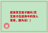 尿液灵芝孢子图片(灵芝孢子在尿液中的惊人发现，图为证！)