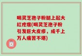 喝灵芝孢子粉腿上起大红疙瘩(喝灵芝孢子粉引发巨大皮疹，成千上万人痛苦不堪)