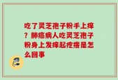 吃了灵芝孢子粉手上痒？肺癌病人吃灵芝孢子粉身上发痒起疙瘩是怎么回事