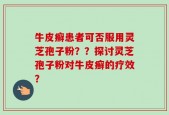 牛皮癣患者可否服用灵芝孢子粉？？探讨灵芝孢子粉对牛皮癣的疗效？