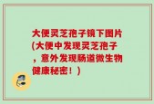 大便灵芝孢子镜下图片(大便中发现灵芝孢子，意外发现肠道微生物健康秘密！)