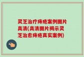 灵芝治疗痔疮案例图片高清(高清图片揭示灵芝治愈痔疮真实案例)