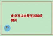 皮炎可以吃灵芝石斛吗图片