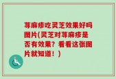 荨麻疹吃灵芝效果好吗图片(灵芝对荨麻疹是否有效果？看看这张图片就知道！)