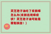 灵芝孢子油吃了皮肤痒怎么办(皮肤出现痒症状？灵芝孢子油可能是罪魁祸首！)