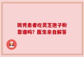 斑秃患者吃灵芝孢子粉靠谱吗？医生亲自解答