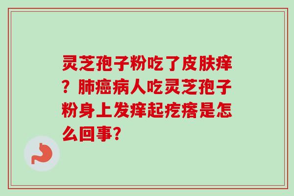 灵芝孢子粉吃了痒?人吃灵芝孢子粉身上发痒起疙瘩是怎么回事? 灵芝孢子粉吃了痒?人吃灵芝孢子粉身上发痒起疙瘩是怎么回事?