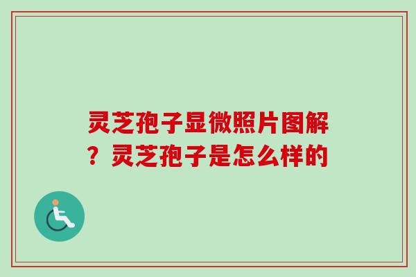 灵芝孢子显微照片图解？灵芝孢子是怎么样的