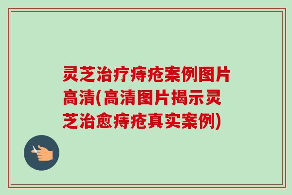 灵芝痔疮案例图片高清(高清图片揭示灵芝愈痔疮真实案例) 灵芝痔疮案例图片高清(高清图片揭示灵芝愈痔疮真实案例)
