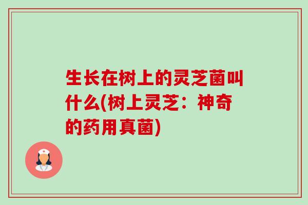 生长在树上的灵芝菌叫什么(树上灵芝:神奇的药用真菌) 生长在树上的灵芝菌叫什么(树上灵芝:神奇的药用真菌)